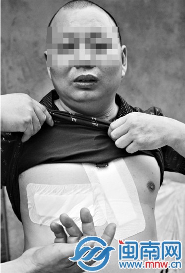 王先生的胸口被連刺了三刀，脖子上的刀傷已留下明顯