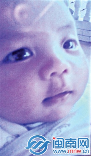第一次手術(shù)后，寶寶眼睛逐漸恢復(fù)，白凈可愛